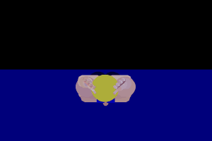 蛙泳.gif