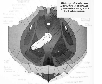 Pubo-coccygeus-finger-cropped.jpg