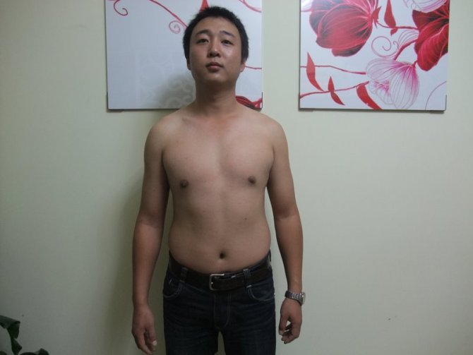 减肥前正面照，2011年3月84KG