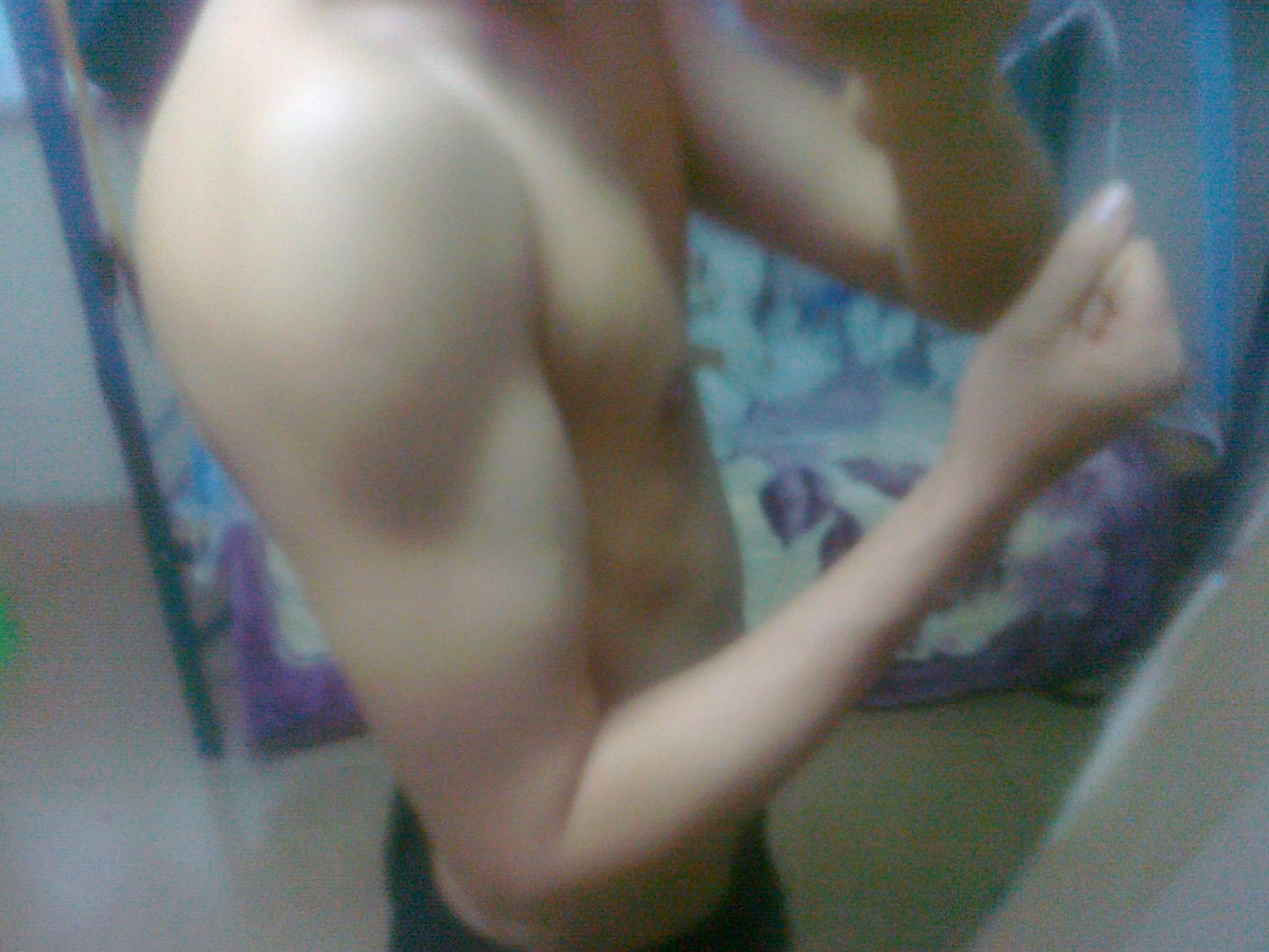 201212左肩.jpg