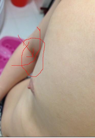 看到画圈地方没，凹里一块
